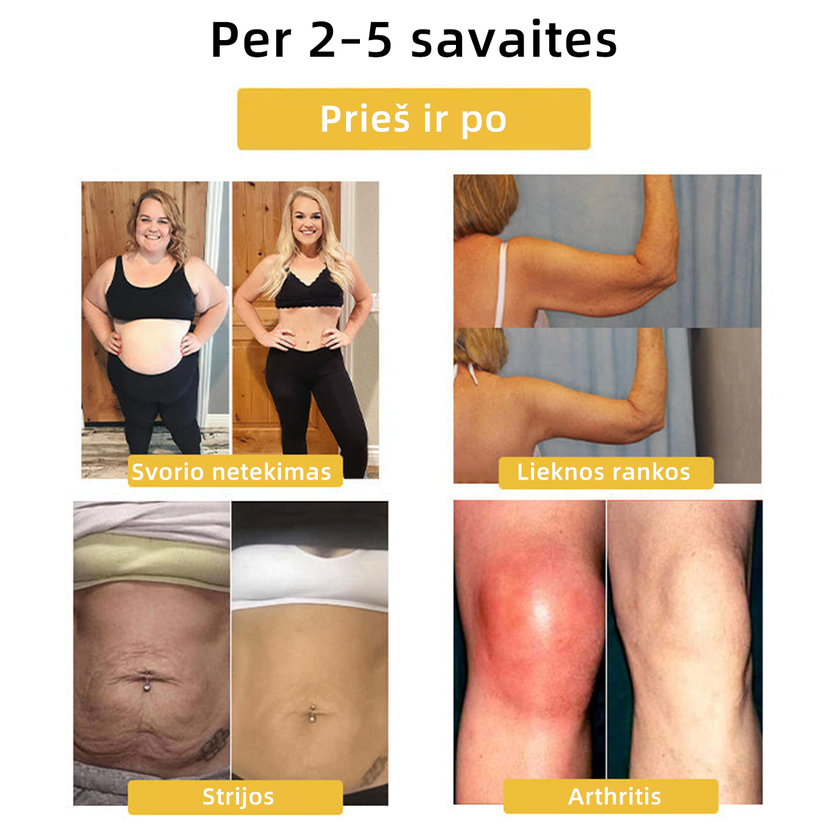 Paskutinės dienos išpardavimas 20% NUOLAIDA -❤️🔥CZTICLE™limfinės magnetinės terapijos katės akių žiedas💍