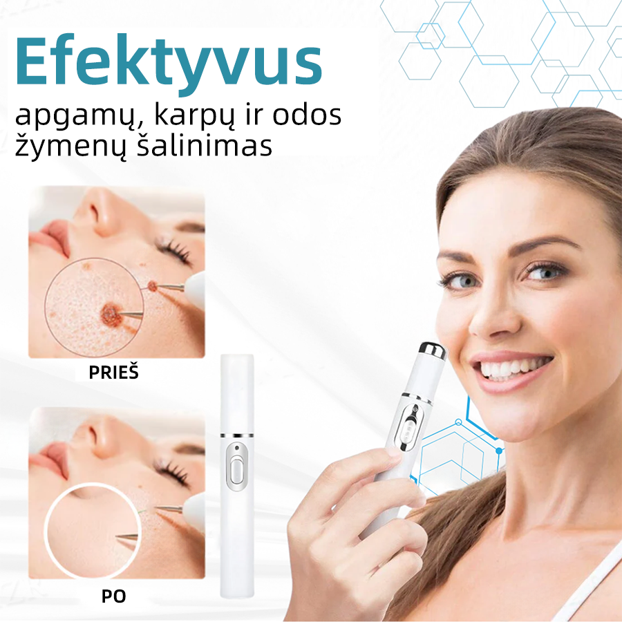 KIDSNEED®💃 neinvazinis apgamų ir karpų šalinimo lazerinis rašiklis – Galingas🔥🔥🔥Lietuvos Medicinos Sąjungos (LMS) rekomendacija