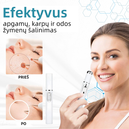 KIDSNEED®💃 neinvazinis apgamų ir karpų šalinimo lazerinis rašiklis – Galingas🔥🔥🔥Lietuvos Medicinos Sąjungos (LMS) rekomendacija