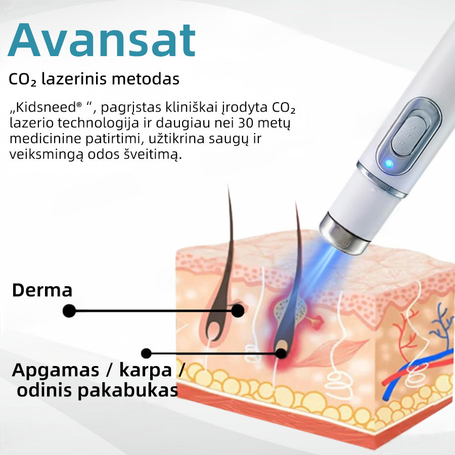 KIDSNEED®💃 neinvazinis apgamų ir karpų šalinimo lazerinis rašiklis – Galingas🔥🔥🔥Lietuvos Medicinos Sąjungos (LMS) rekomendacija