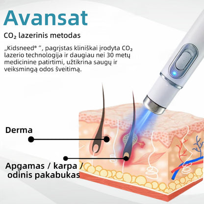 KIDSNEED®💃 neinvazinis apgamų ir karpų šalinimo lazerinis rašiklis – Galingas🔥🔥🔥Lietuvos Medicinos Sąjungos (LMS) rekomendacija