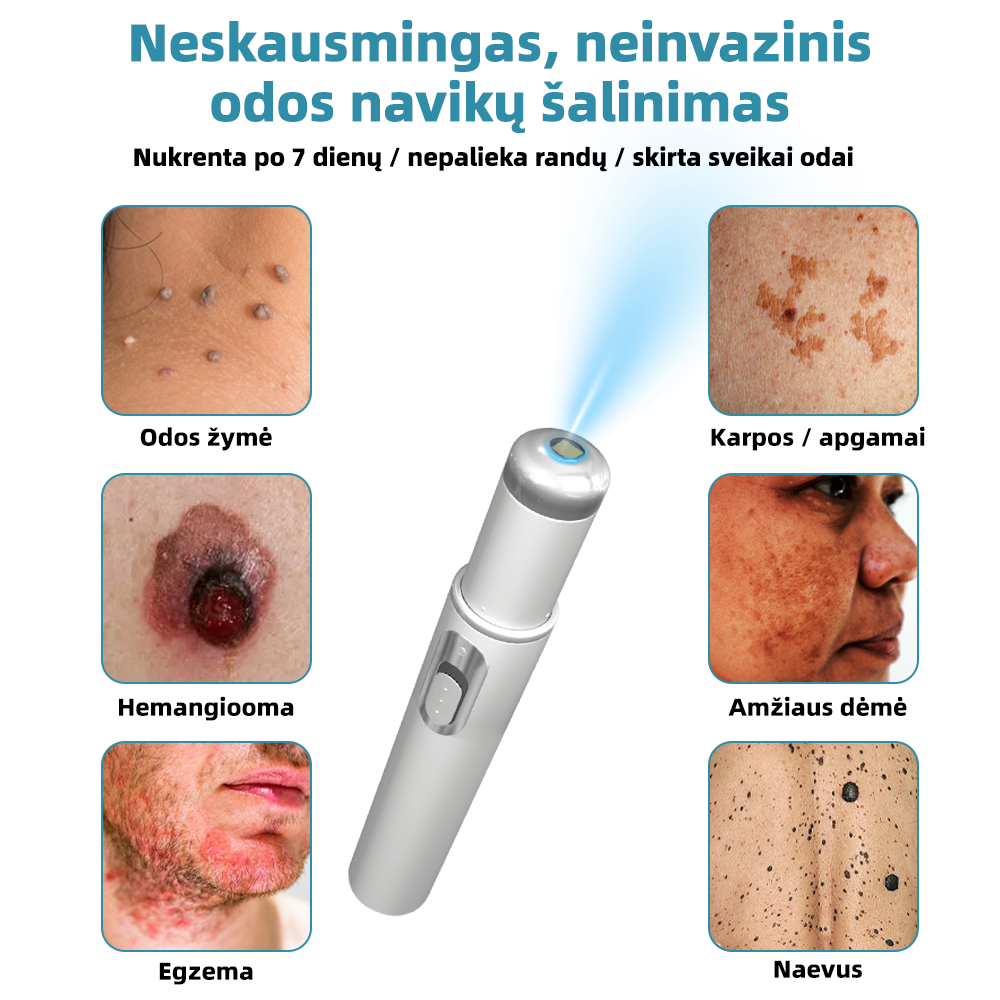 KIDSNEED®💃 neinvazinis apgamų ir karpų šalinimo lazerinis rašiklis – Galingas🔥🔥🔥Lietuvos Medicinos Sąjungos (LMS) rekomendacija